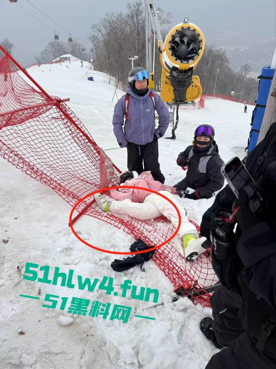 北大湖滑雪场新手滑雪妹，误入中高级滑道滑雪，不慎摔飞被撞到变形断腿场面超吓人。
