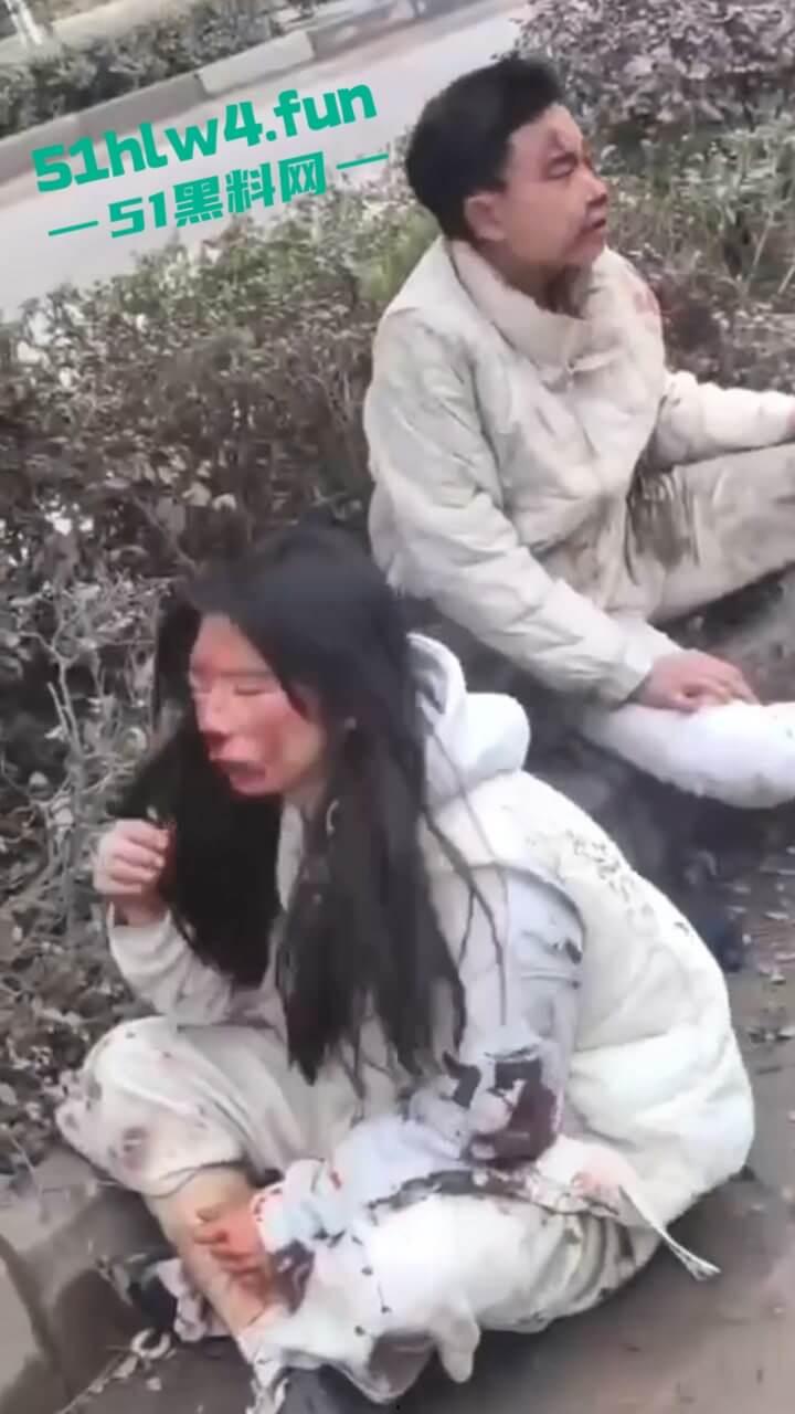 内江资中奇葩车祸五菱宏光加速超车，竟然失控出车祸俩人都变成熊猫脸，看着太搞笑了。