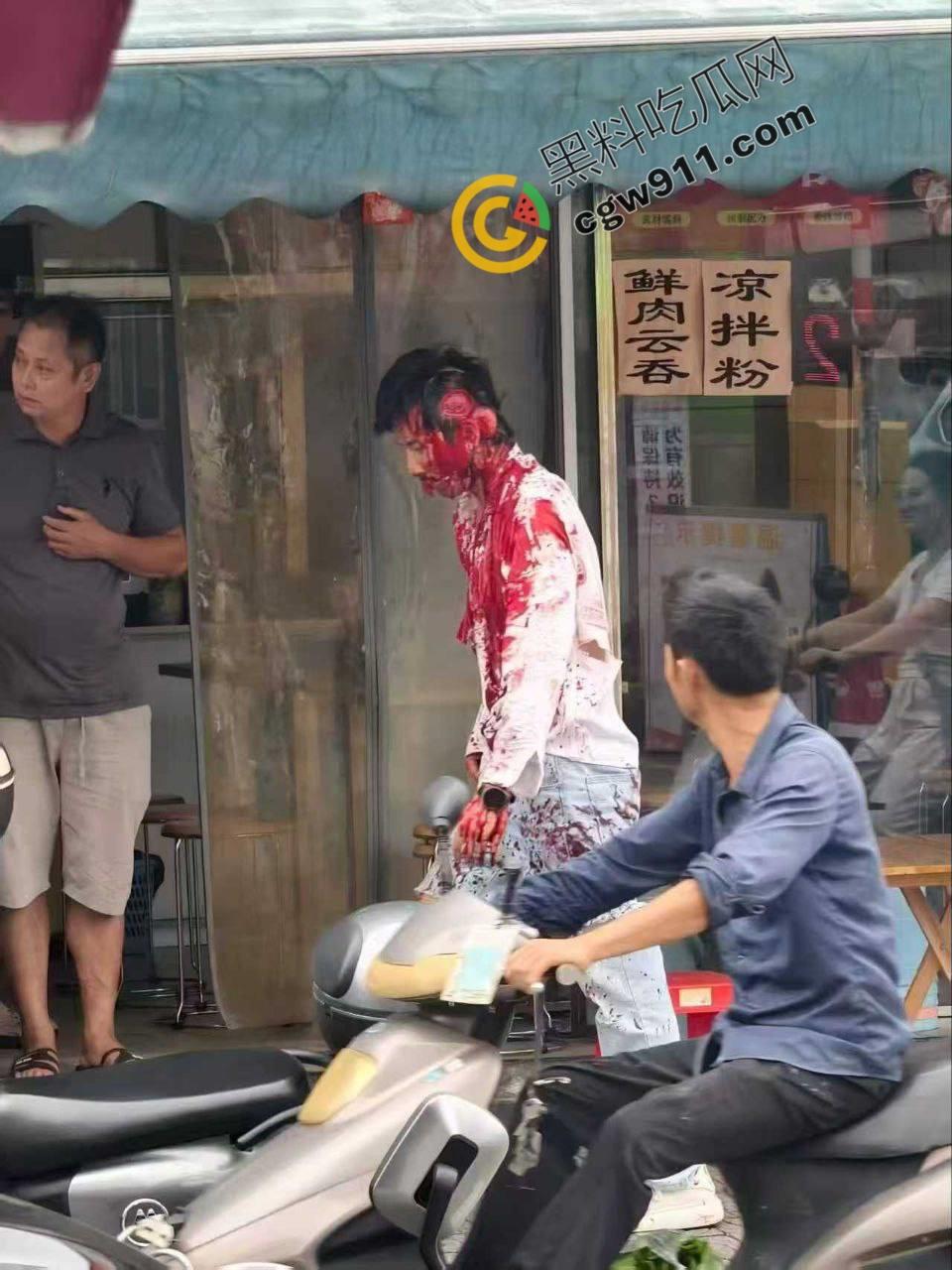 广西柳州街头疯狂砍人事件!男子疯狂持刀追砍,残暴削掉头皮,引爆全城惊恐!