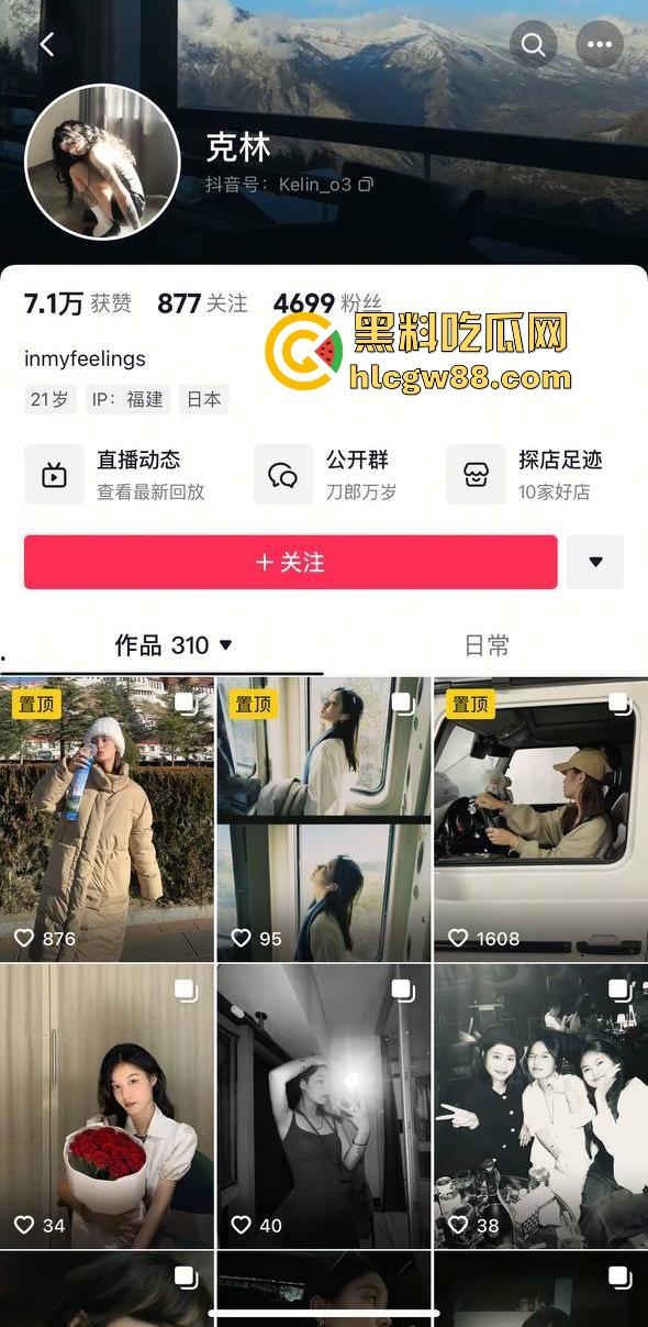 抖音厦门母狗【黄淮北】到处约炮聊骚居家狂热自慰 出去约炮时胸口的挂坠被实锤本人无疑！