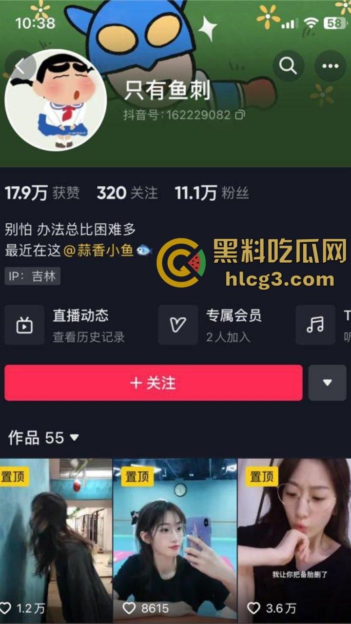 抖音网红『只有鱼刺』真空激凸舞蹈视频流出!长腿眼镜婊激情热舞乳头清晰可见!