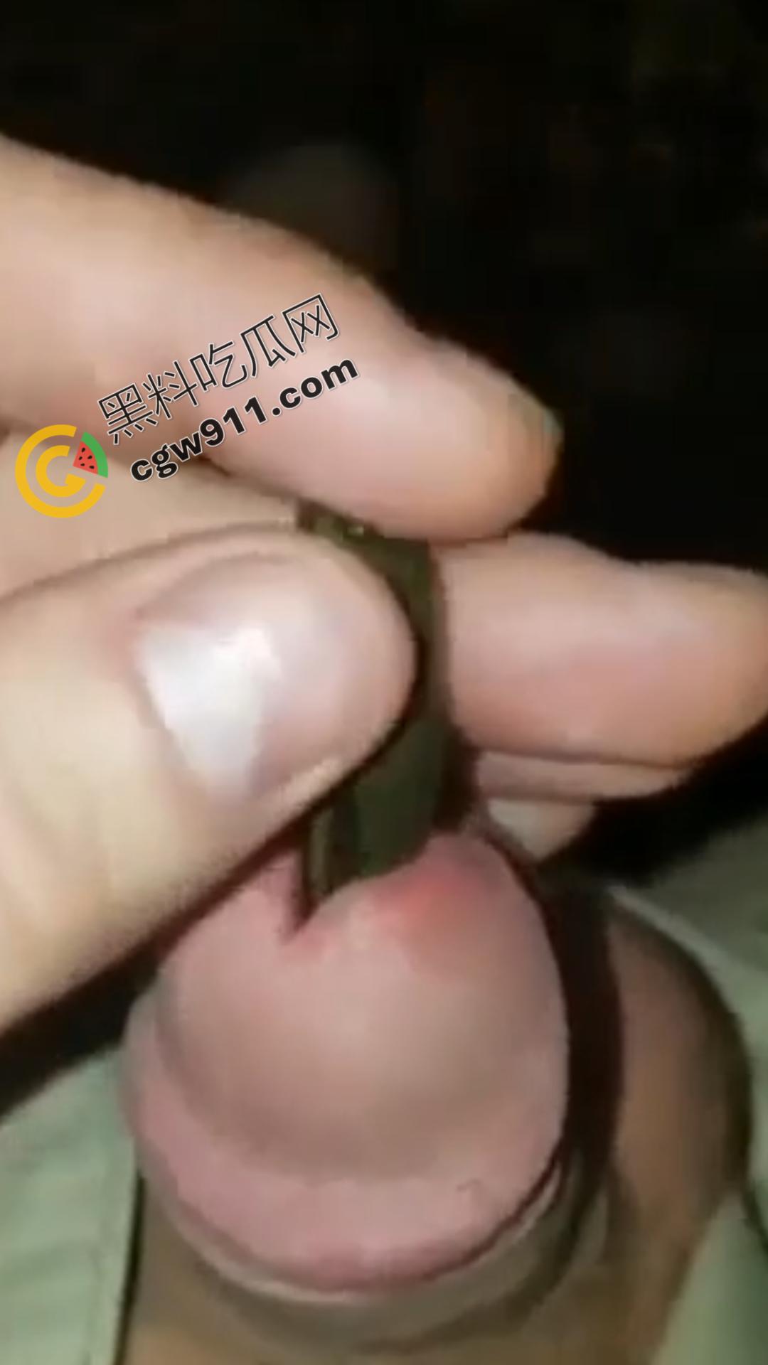 恐怖刺激!活蚂蟥钻入男子大屌的惊悚作死视频,观看者直呼恶心,视觉冲击骇人听闻
