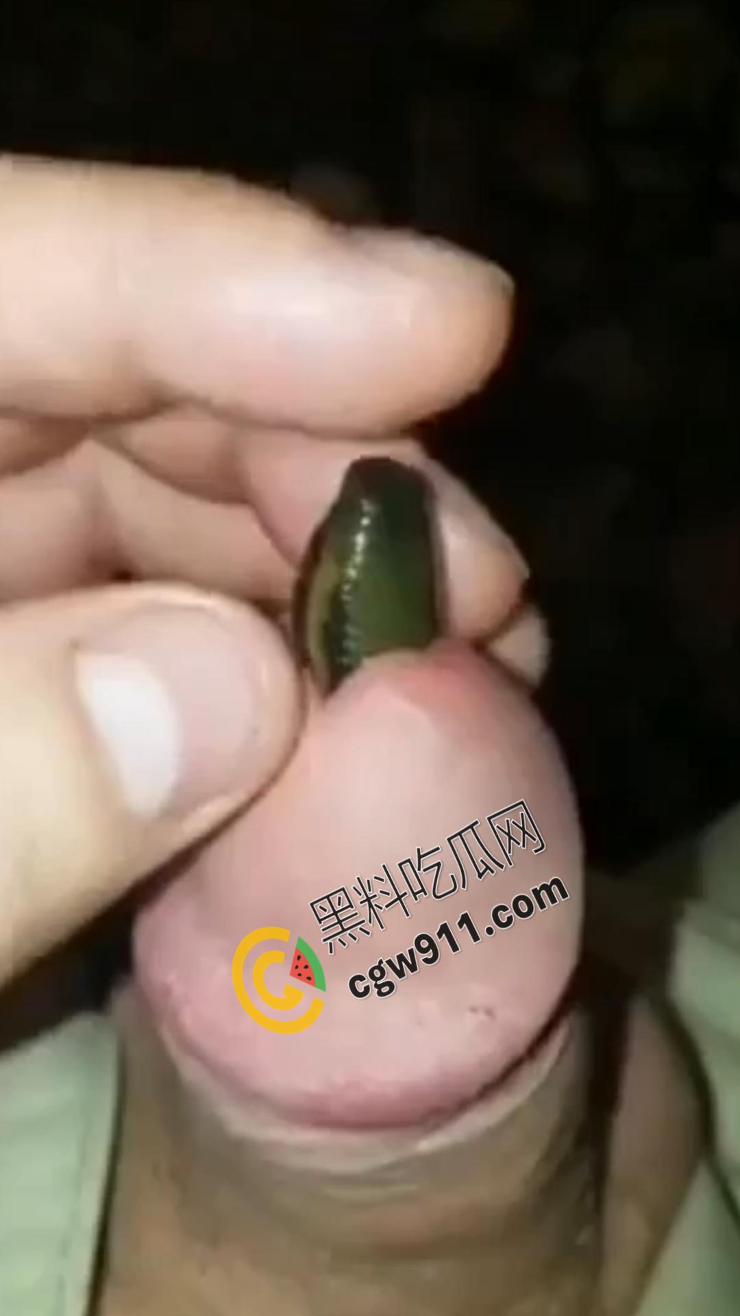 恐怖刺激!活蚂蟥钻入男子大屌的惊悚作死视频,观看者直呼恶心,视觉冲击骇人听闻