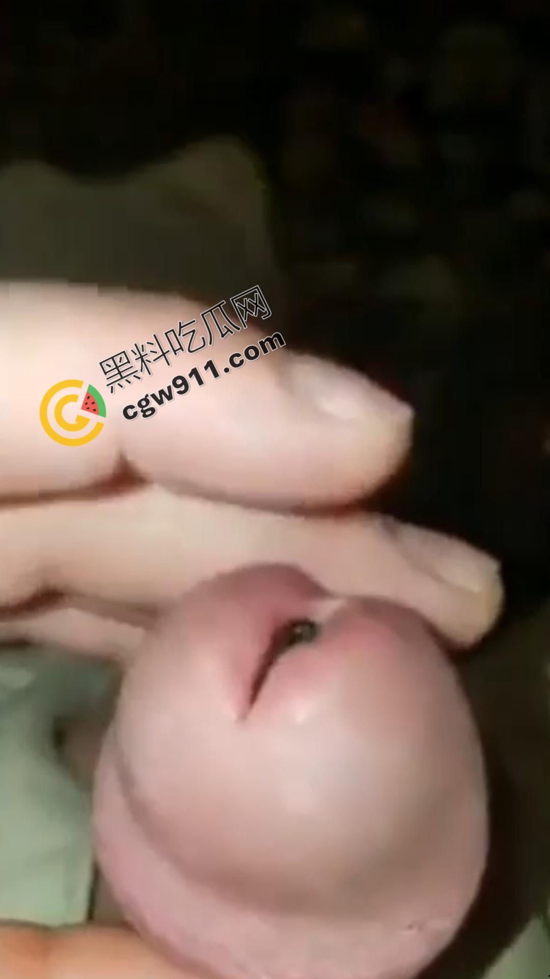 恐怖刺激!活蚂蟥钻入男子大屌的惊悚作死视频,观看者直呼恶心,视觉冲击骇人听闻