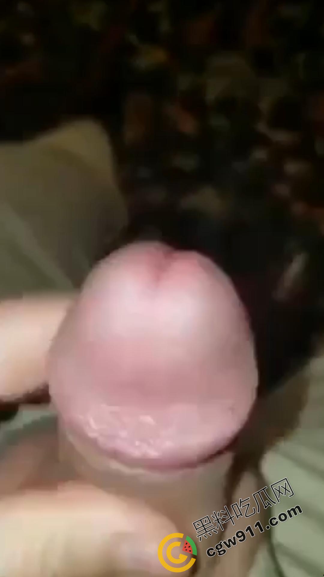 恐怖刺激!活蚂蟥钻入男子大屌的惊悚作死视频,观看者直呼恶心,视觉冲击骇人听闻