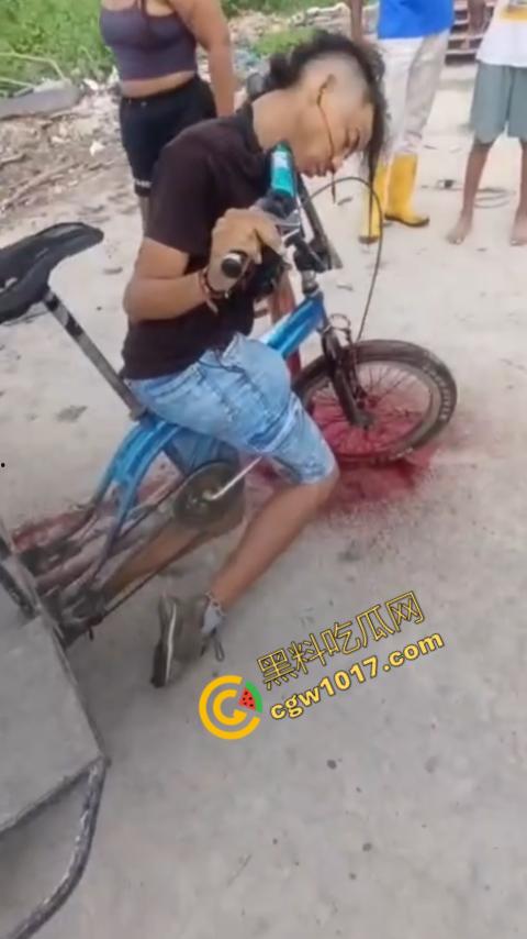 恐怖视频曝光!小伙头颅神秘贯穿,三轮车穿颅血染街头血腥现场骇人惊魂,神秘死亡惊掉下巴!