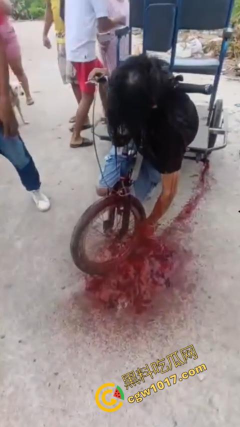 恐怖视频曝光!小伙头颅神秘贯穿,三轮车穿颅血染街头血腥现场骇人惊魂,神秘死亡惊掉下巴!