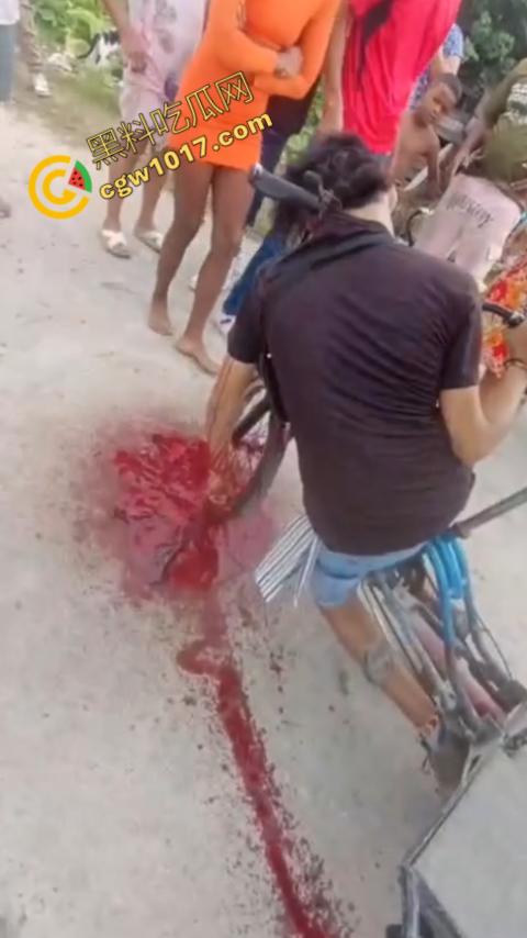 恐怖视频曝光!小伙头颅神秘贯穿,三轮车穿颅血染街头血腥现场骇人惊魂,神秘死亡惊掉下巴!