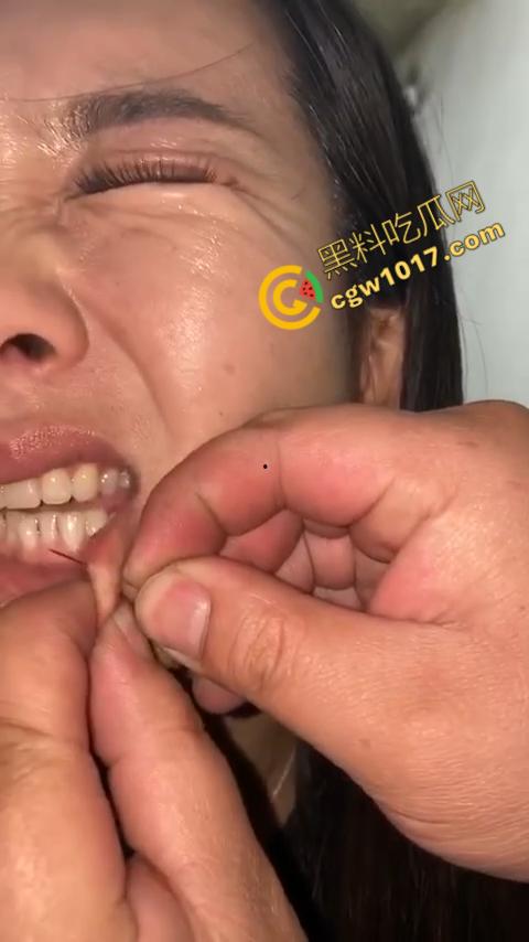 湖南偏僻村庄恐怖游戏:嘴唇缝合,女子痛苦享受,男子冷血针线,极限挑战人,真是够变态