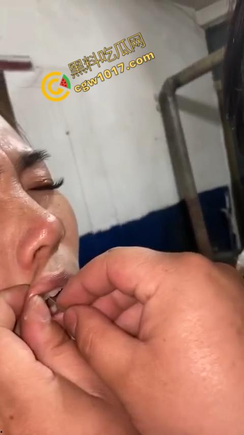 湖南偏僻村庄恐怖游戏:嘴唇缝合,女子痛苦享受,男子冷血针线,极限挑战人,真是够变态