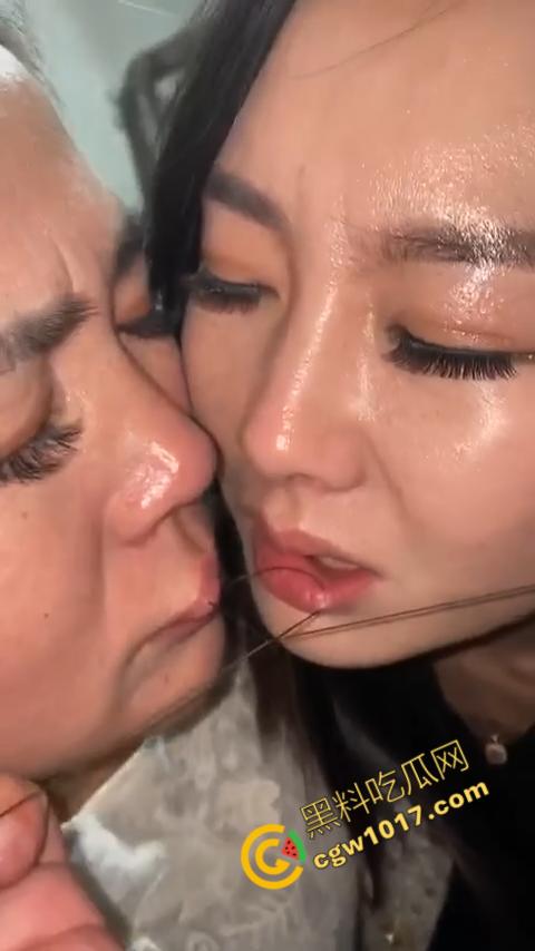 湖南偏僻村庄恐怖游戏:嘴唇缝合,女子痛苦享受,男子冷血针线,极限挑战人,真是够变态