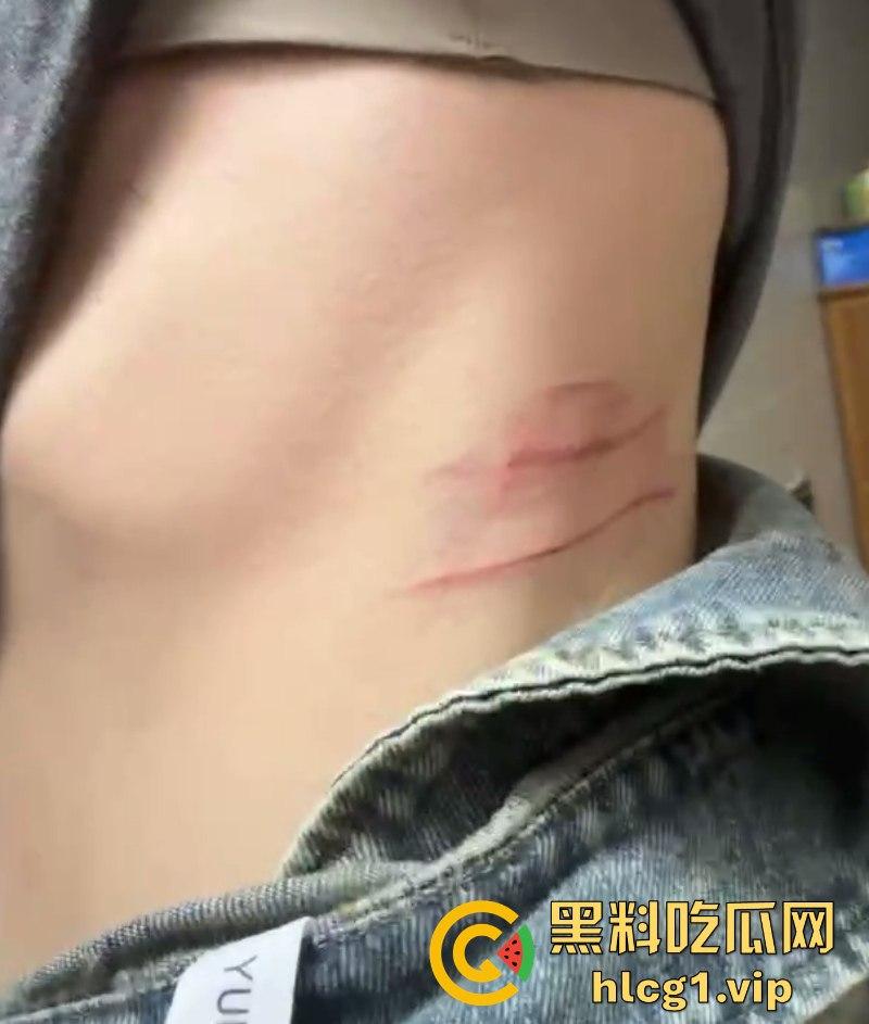 揭东区庵后村家暴男【高浩南】 不仅喜欢出轨还不怕报警 专吃硬的不愧是浩南哥!