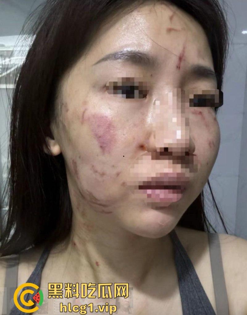 揭东区庵后村家暴男【高浩南】 不仅喜欢出轨还不怕报警 专吃硬的不愧是浩南哥!