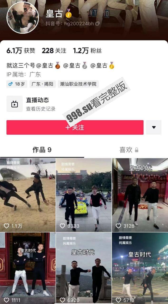 抖音 精神小伙 皇古 直播装逼失败裤裆着火 希望老二还能保住