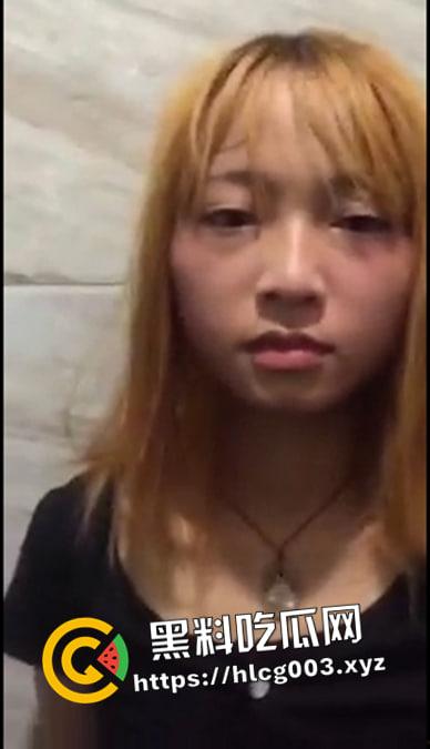 精神小妹酸奶倒进逼里  不自慰就被打 脸和逼都被打肿了 现场视频流出