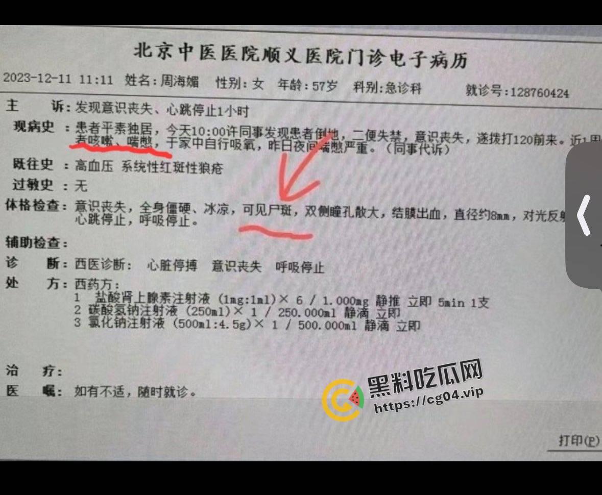 最新！周海媚死亡病例流出 去世前身上已有尸斑  流出的医生将被严惩